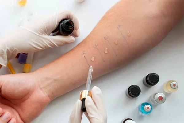 Allergy Testing
